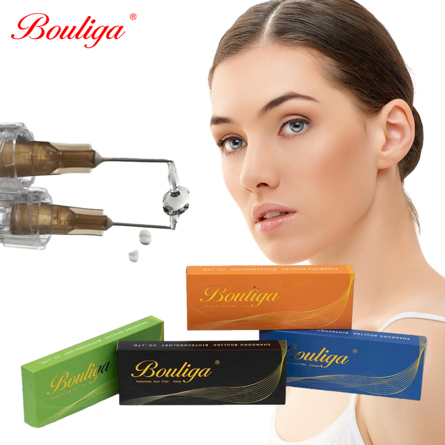 2 ml injizierbares Hyaluronsäuregel zur Lippenvergrößerung