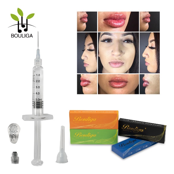 Injizierbare 1 ml 2 ml 3 ml 5 ml vernetzte Hyaluronsäure-Injektionen Hautfüller/Ha-Füller für Lippen, Nase, Falten, Brust, Gesäß, Körper, Gesicht, Hals, Falten